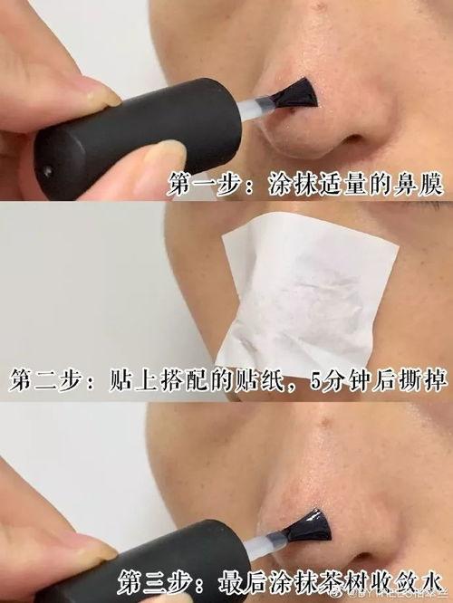去黑头明星网红有哪些,明星网红们的护肤秘籍大公开